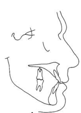 <p>how would you classify this profile </p>