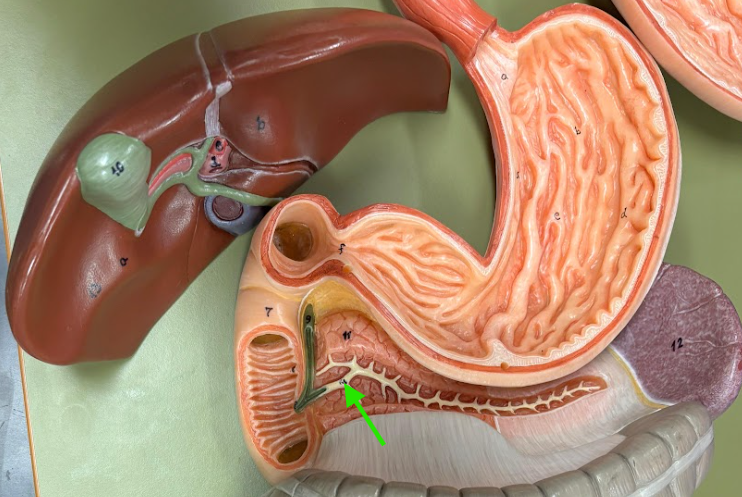 <p>What is the arrow pointing at?</p>