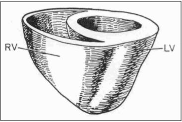 <p>Right ventricle - deoxygenated blood to lungs - less thick</p><p>Left ventricle - oxygenated blood to body - thicker</p>