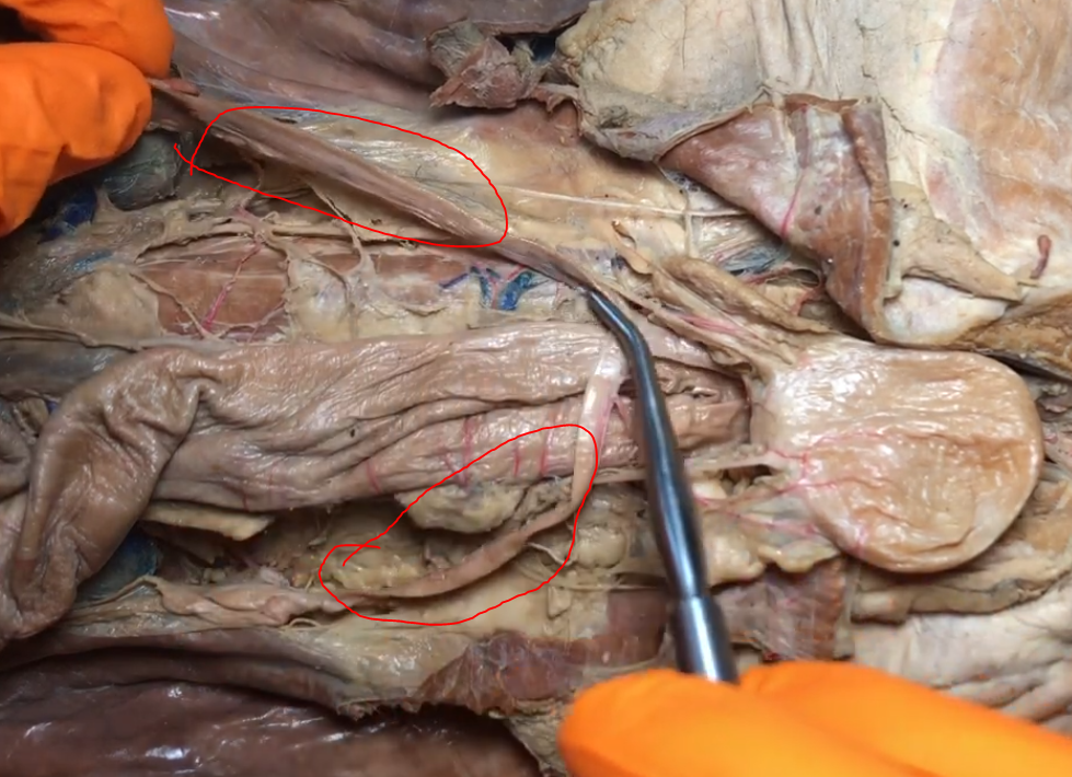 <p>What structure is this?</p>