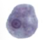 <p>What Amebae is this? Is this the trophozoite or cyst form?</p>