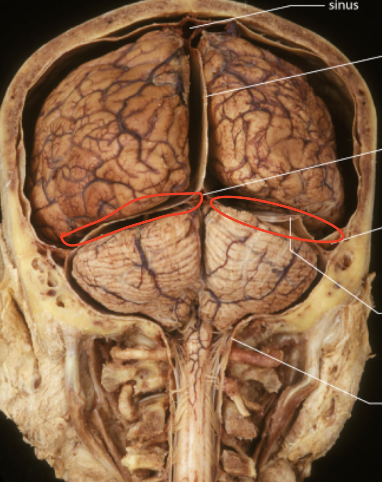 <p>Seperates the cerebrum and cerebellum </p>