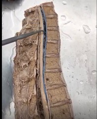 <p>Name the ligament</p>