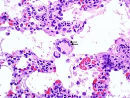 <p><span>Thin, dividing walls or membranes that separate cavities, tissues, or cells within organisms, providing structural support, compartmentalization, and regulation of material flow</span></p>