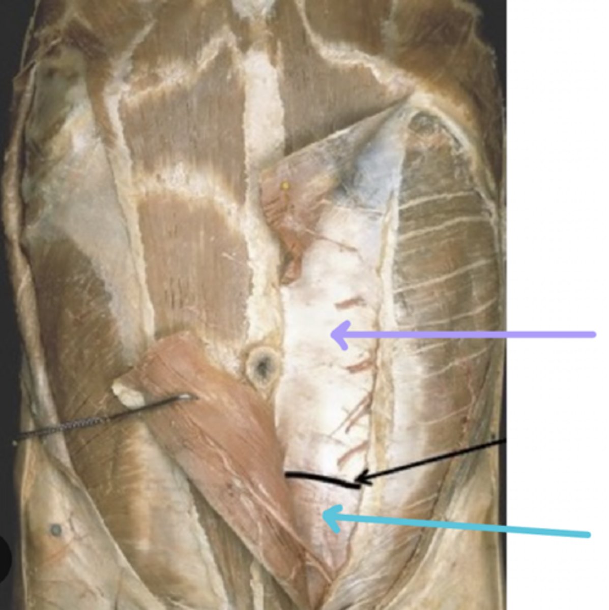 <p>blue arrow</p>