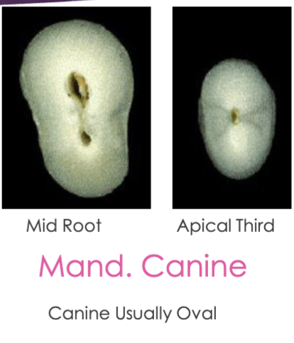 <p>usually oval, mid root can start separate and then join in apical third </p>