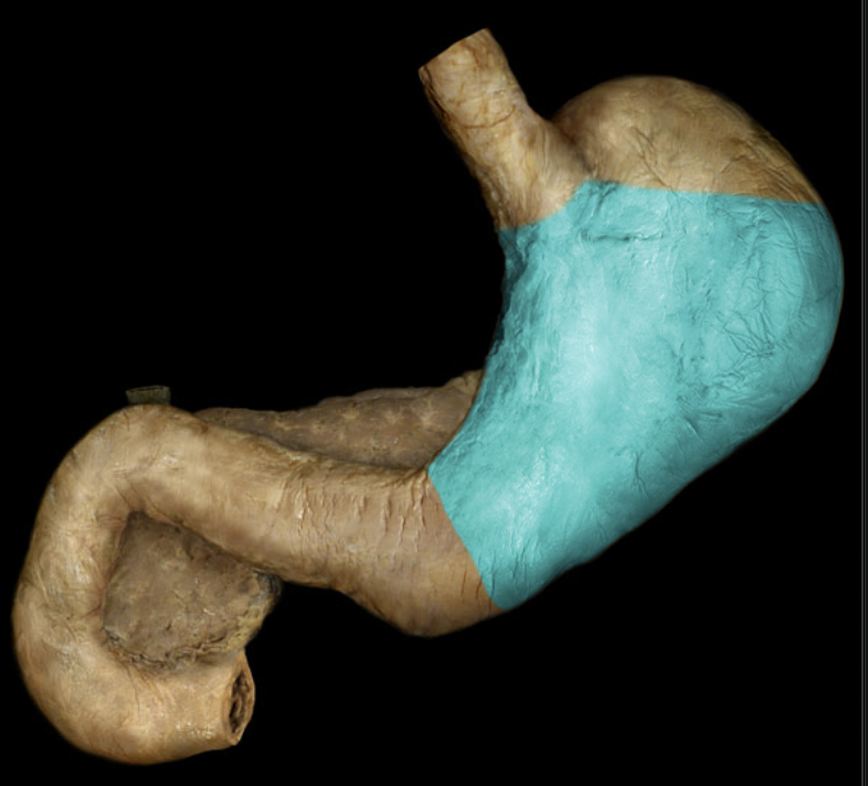 term image