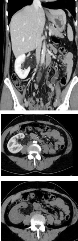 <ol><li><p>Imenuj tehniko slikanja </p></li><li><p>Naštej anatomske strukture, prikazane na sliki </p></li><li><p>Kakšna je razlika med slikami? </p></li><li><p>Kateri je položaj slikanja? </p></li><li><p>Opiši patološke spremembe na sliki </p></li><li><p>Diagnoza?</p></li></ol><p></p>