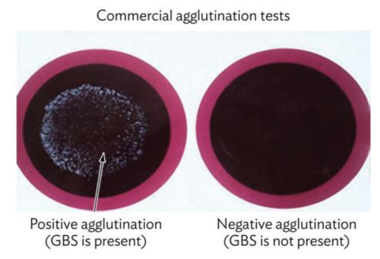 <p>assays that measures ____ ____ insoluble antigens, can check for blood type using ___ specific to that thing</p>