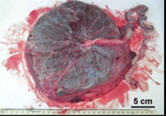 <p>Shiny, smooth, large blood vessels coursing through the membranous surface</p>