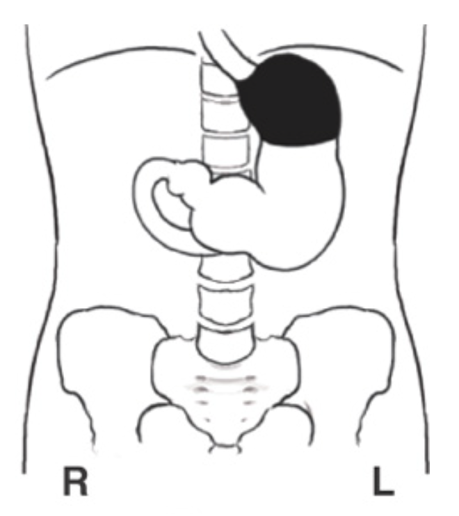 <p>What patient position is this?</p>