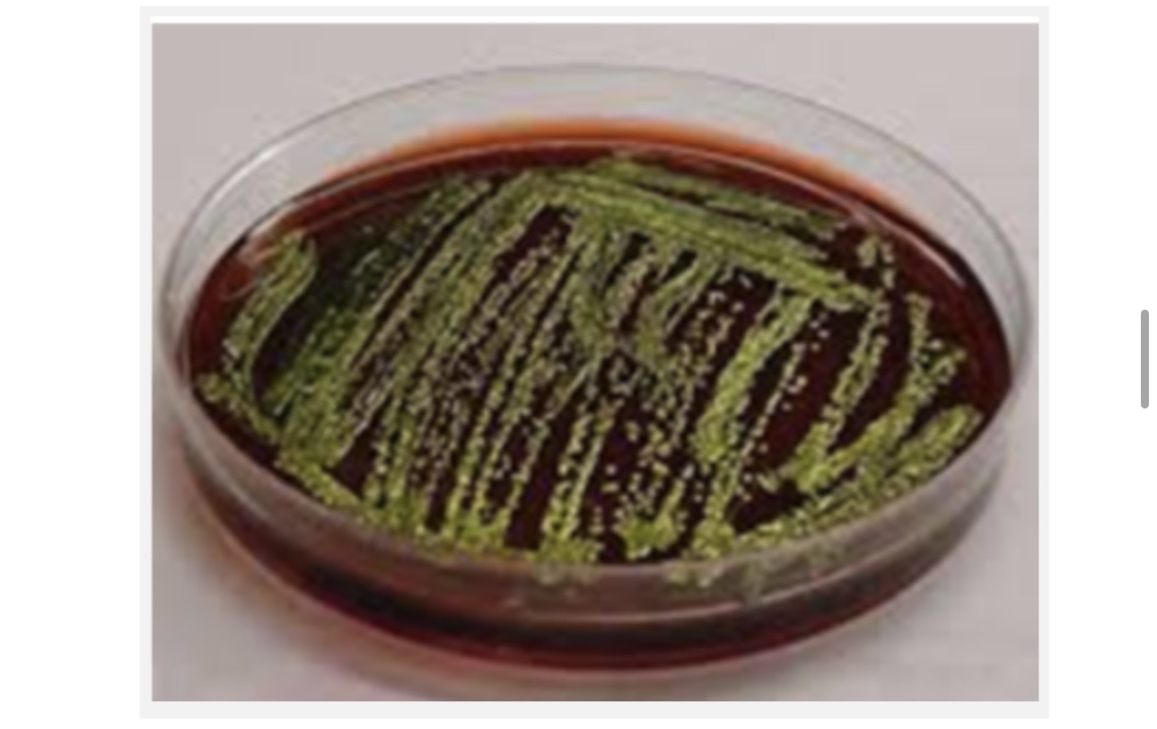 <p>Based on what you see here answer the following</p><p>A. What experiment are you performing and which day? </p><p>B. What media are you using? </p><p>C. What bacteria did you just find? </p>