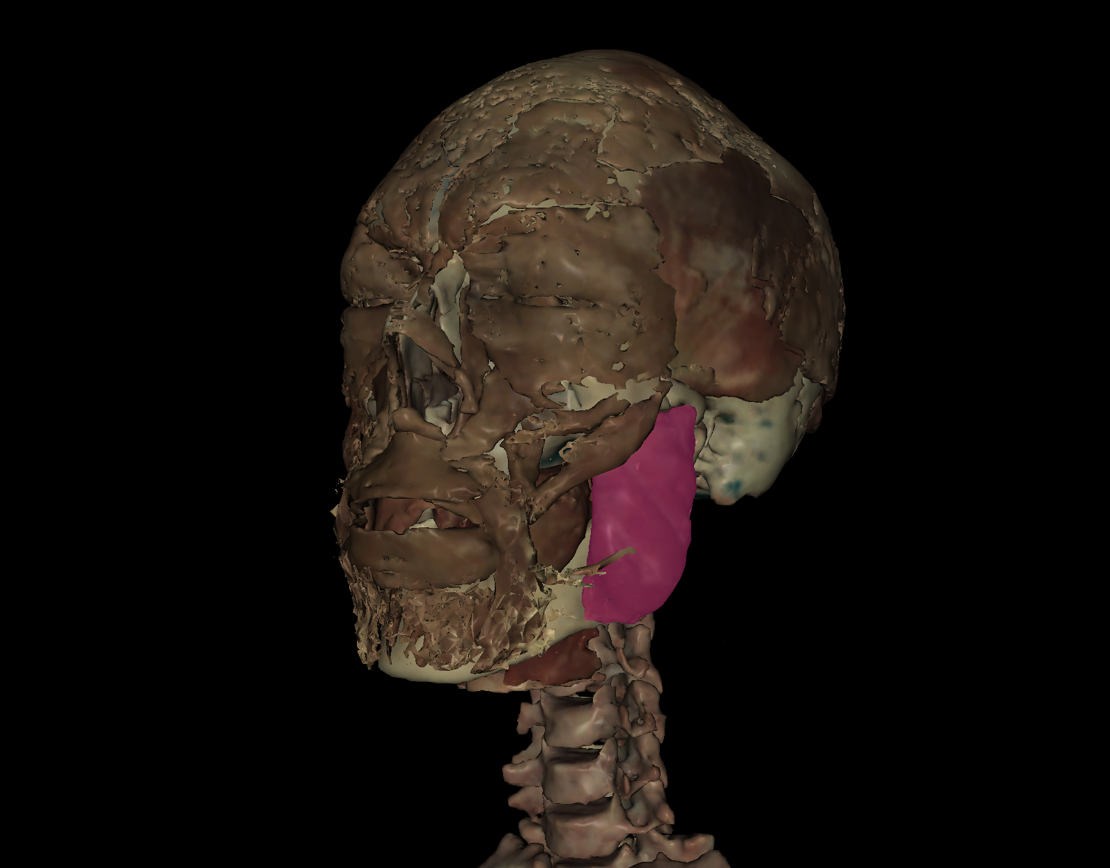 term image