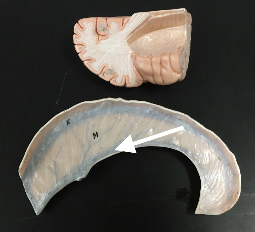 <p>What is the blue structure the arrow is pointing to?</p>