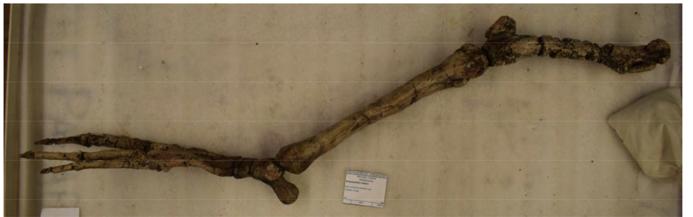 <p>reduced forearm</p>