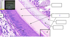 <p>What is structure 1</p>