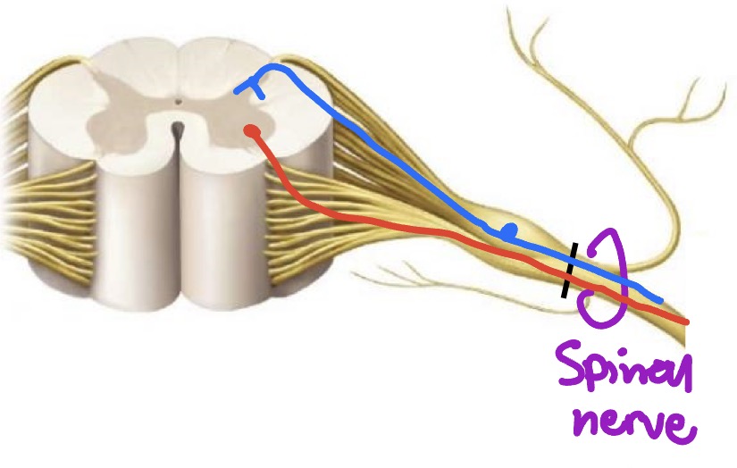 <p>What type of signal would be interrupted here?</p>