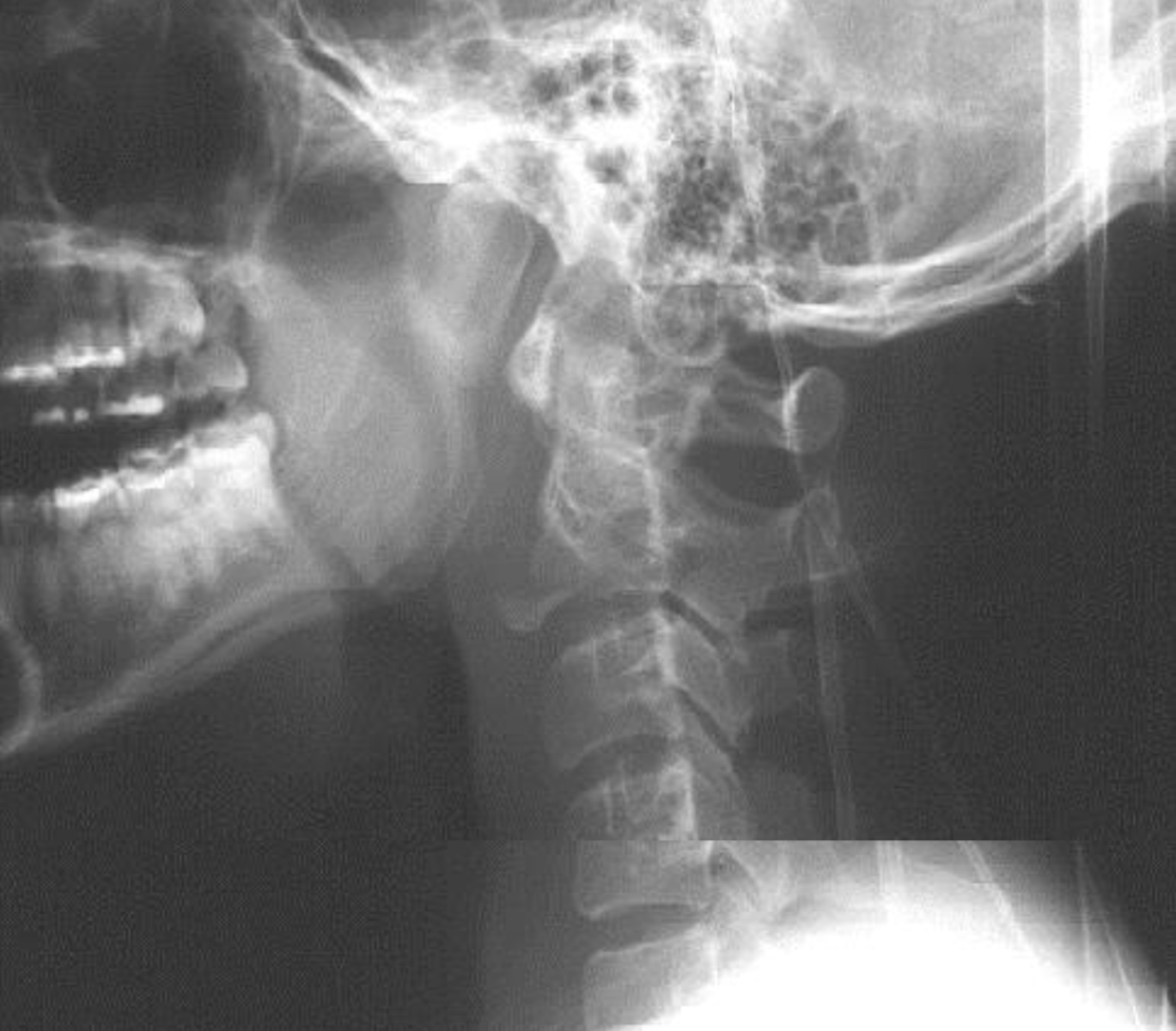 <p>What is the diagnosis?</p>