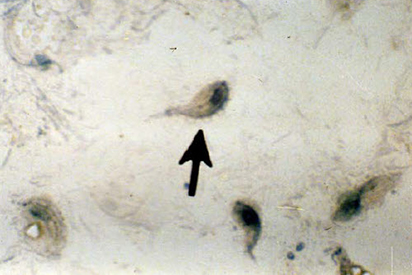 <p>Identify the parasite</p>