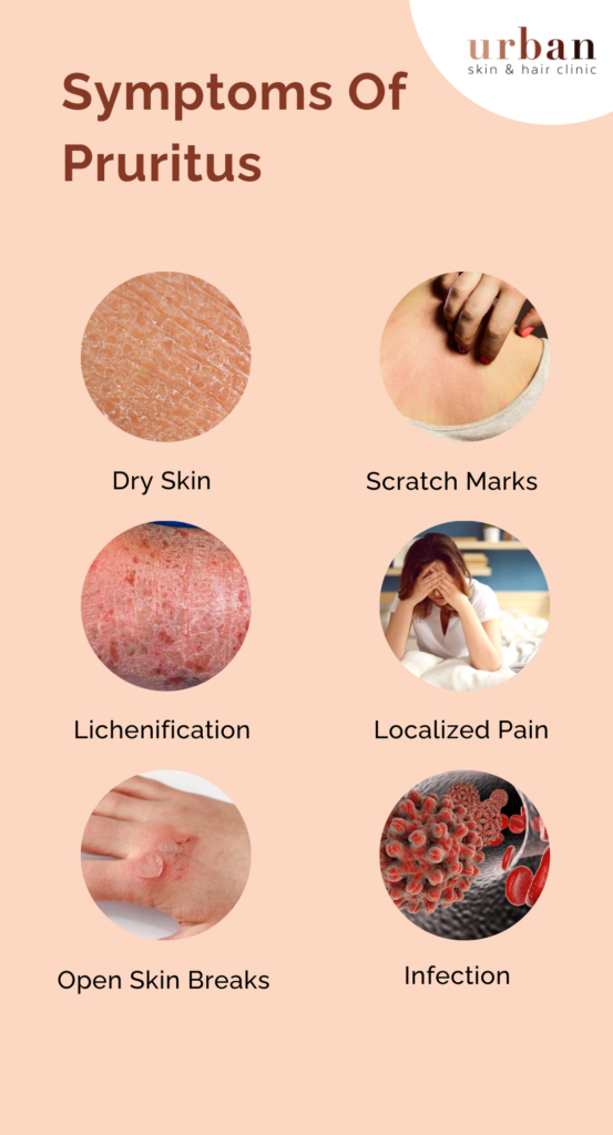 <p>Pruritus</p>