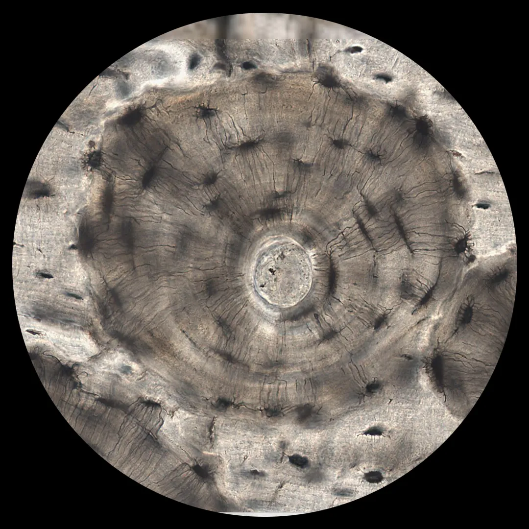 <p><strong><mark data-color="#f8f9c5" style="background-color: rgb(248, 249, 197); color: inherit;">Sistema de Havers</mark></strong></p>