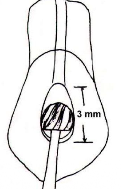 <p>1-1/2mm and 2mm at widest point</p>