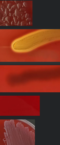 <p><span>You have a patient with a sore throat.&nbsp; You suspect </span><em>Streptococcus pyogenes.</em><span>&nbsp; </span><em>S. pyogenes </em><span>is a Gram-positive cocci that is beta hemolytic.&nbsp; It is not a halophile.&nbsp; It does not ferment lactose or mannitol.&nbsp; What would you observe if you plated this sample on a SBA plate?</span></p>