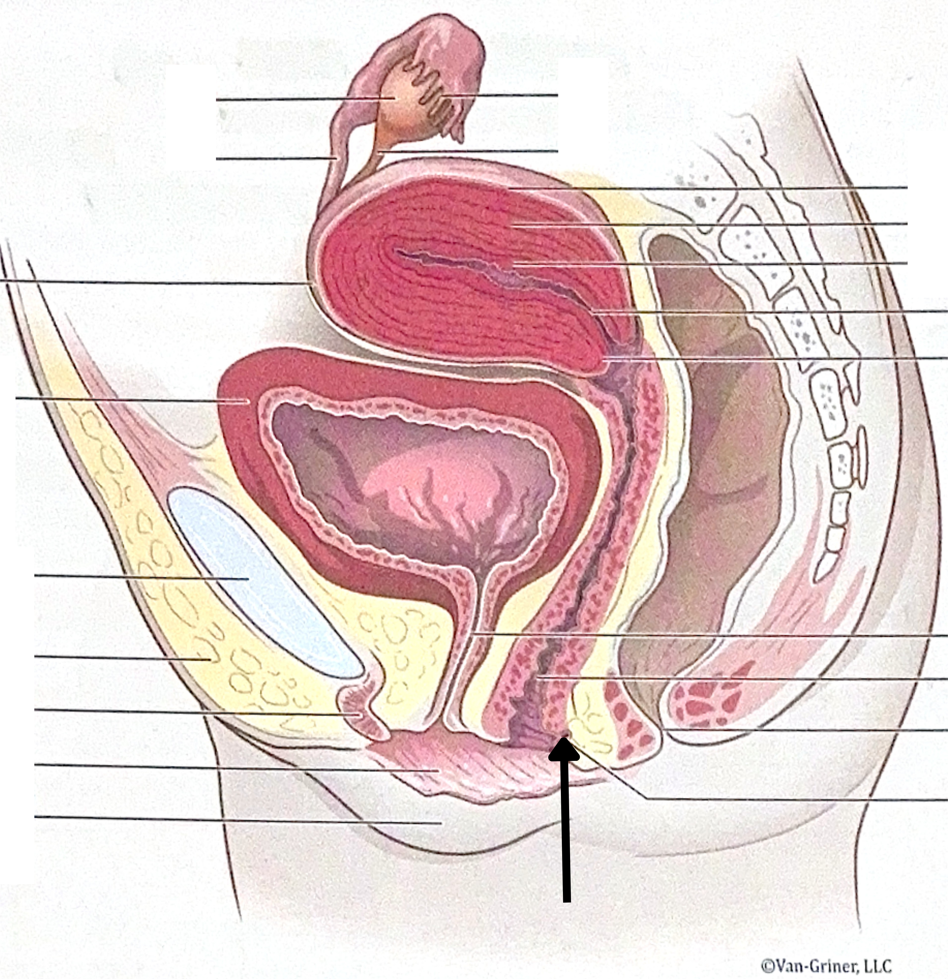<p>What is the structure indicated in the image?</p>