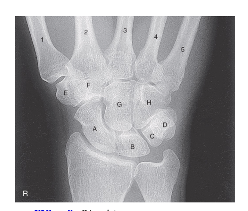 <p>H</p>