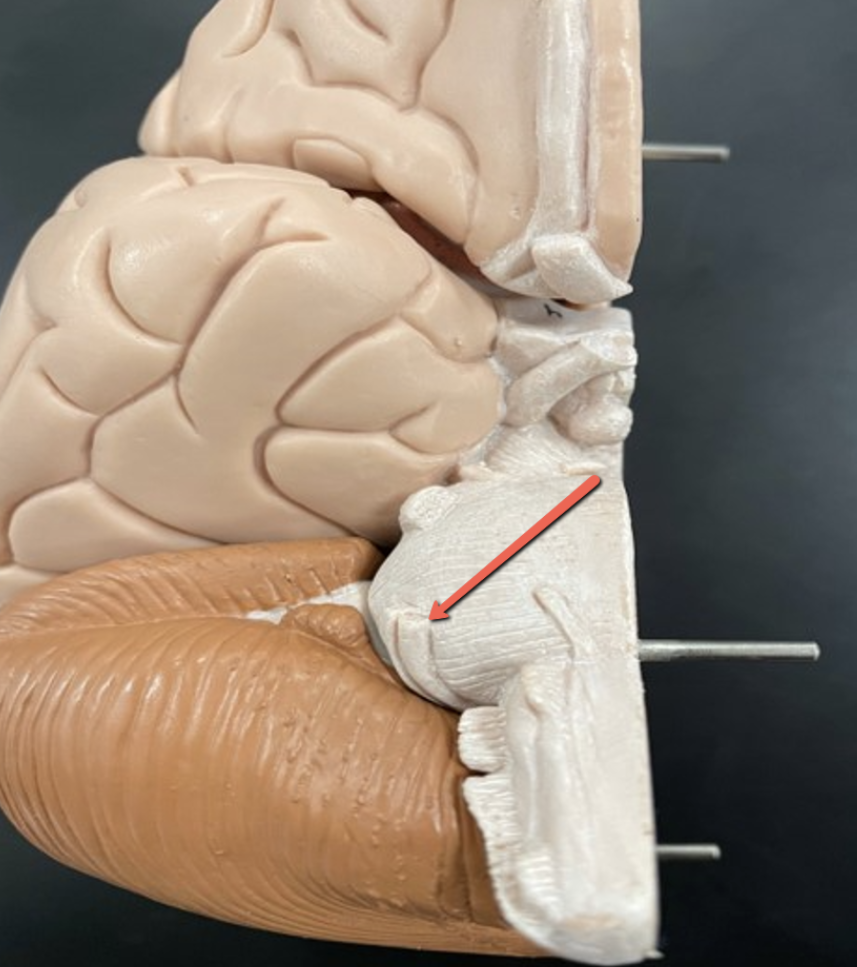 <p><span><strong>Identify the cranial nerve indicated by the pointer.</strong></span></p>