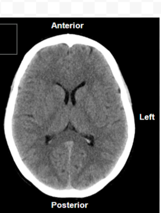 <p>Type of scan, orientation</p>