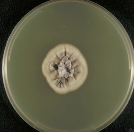 <p>To isolate and grow fungi (like yeast and mold). Growth-wise, Yeast would be elevated, moist, and glistening. Mold would be fuzzy and powdery. </p>