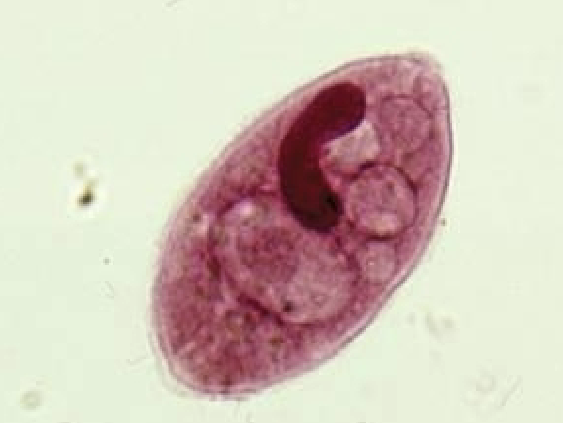 <p>What protist is this? (genus name)</p>