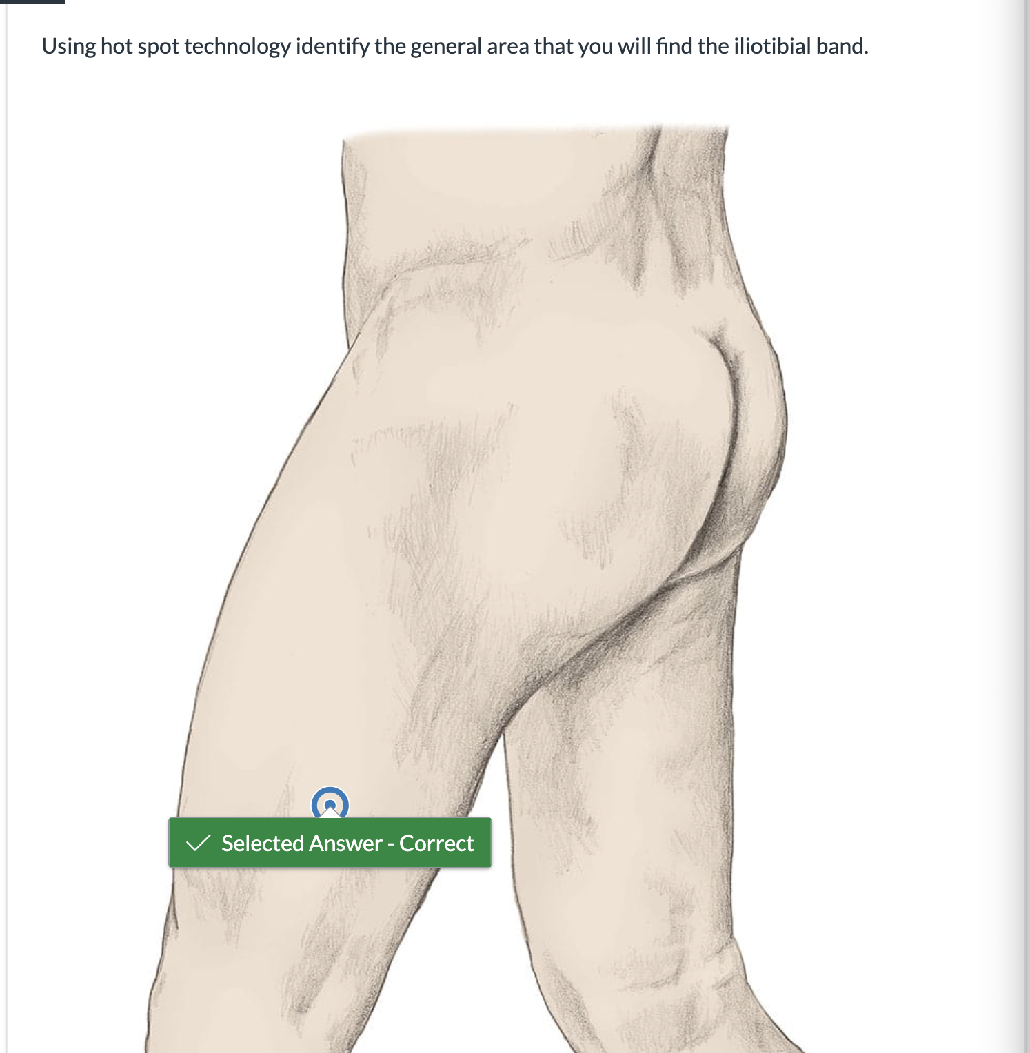 <p><span>Using hot spot technology identify the general area that you will find the iliotibial band.</span></p>