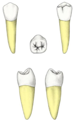 <p>Which tooth?</p>