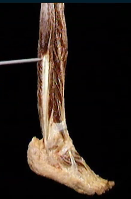 <p>Diep, boven voet</p>