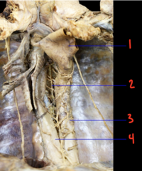 <p>What is labeled 1?</p>