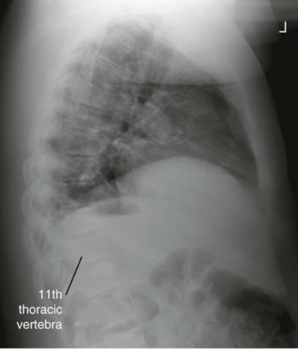 <p>Lateral Chest: Is this Image Good?</p>