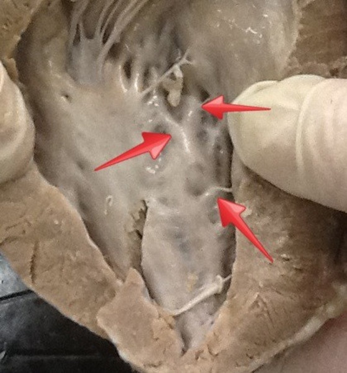 <p>Lattice‑like bone structures.</p>