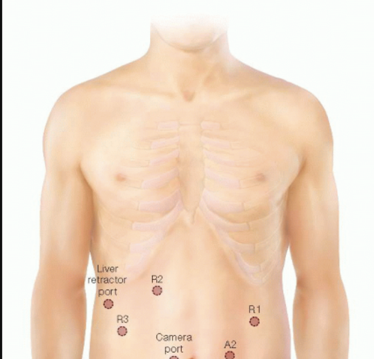 <p><strong>What are the proper placements and sequence for auscultating lungs anteriorly?</strong></p>