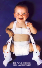 <p>- Pavlik Harness (90% successful)</p><p>- Flex 100°, Abduct to 50°</p><p>- Re-eval in three weeks by U/S</p><p>- Duration of 3 months</p>