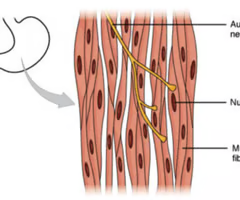 <p><span>single unit</span><br><br><span>(Note: found in stomach,</span><br><span>uterus, and urinary bladder)</span></p>