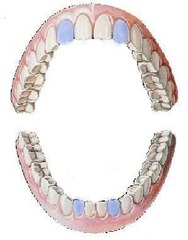 <p>lateral incisors</p>