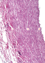 <p>What layer of the elastic artery is labeled 3?</p>