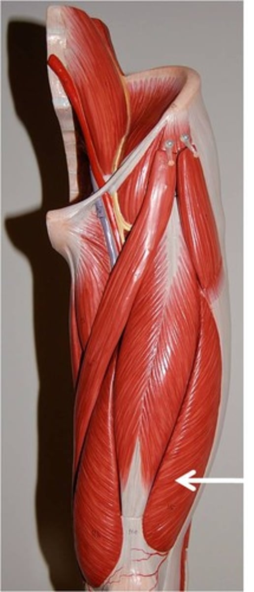 <p>Part of the quadriceps group</p><p>Action - extends leg at the knee; part of the quadriceps group</p>