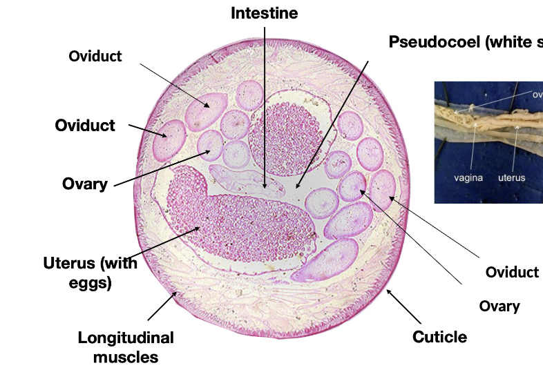 <p>round worm, nematoda, female</p>