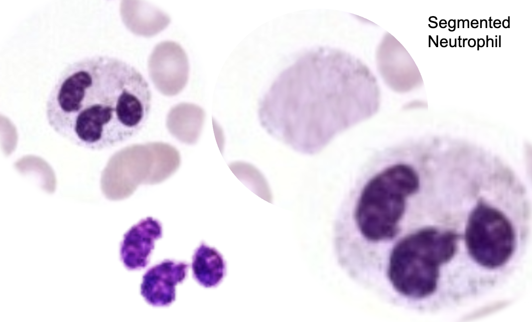 <p>Neutrophils</p>