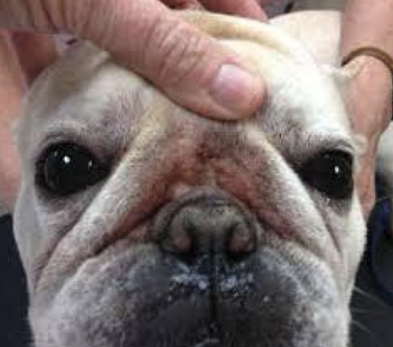 <p>Intertrigo (Skin Fold Dermatitis)</p>