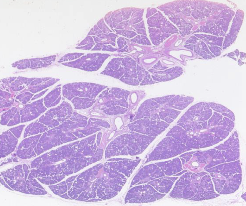 <p>parotid gland: : serous alveoli, excretory duct</p>