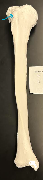 <p>ID tibia projection </p>